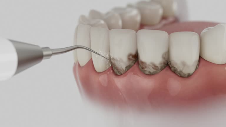 Trusted Teeth Cleaning And Checkup service in Butler, GA - Dentist Open Now